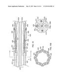 MULTI-ELECTRODE BALLOON CATHETER WITH CIRCUMFERENTIAL AND POINT ELECTRODES diagram and image