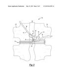 Adjustable Loop Constructs And Techniques diagram and image