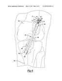 Adjustable Loop Constructs And Techniques diagram and image