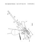 APPARATUS AND METHODS FOR BONE ACCESS AND CAVITY PREPARATION diagram and image