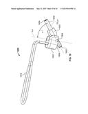 APPARATUS AND METHODS FOR BONE ACCESS AND CAVITY PREPARATION diagram and image