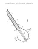 APPARATUS AND METHODS FOR BONE ACCESS AND CAVITY PREPARATION diagram and image