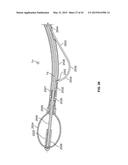 APPARATUS AND METHODS FOR BONE ACCESS AND CAVITY PREPARATION diagram and image