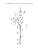 APPARATUS AND METHODS FOR BONE ACCESS AND CAVITY PREPARATION diagram and image