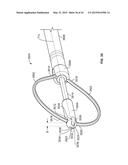 APPARATUS AND METHODS FOR BONE ACCESS AND CAVITY PREPARATION diagram and image