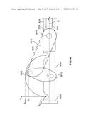 APPARATUS AND METHODS FOR BONE ACCESS AND CAVITY PREPARATION diagram and image