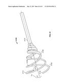 APPARATUS AND METHODS FOR BONE ACCESS AND CAVITY PREPARATION diagram and image