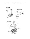 SYSTEMS AND METHODS FOR POSITIONING AN ELONGATE MEMBER INSIDE A BODY diagram and image