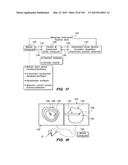 SYSTEMS AND METHODS FOR POSITIONING AN ELONGATE MEMBER INSIDE A BODY diagram and image