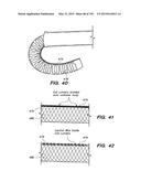 SYSTEMS AND METHODS FOR POSITIONING AN ELONGATE MEMBER INSIDE A BODY diagram and image