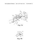 ROTATIONAL ATHERECTOMY DEVICE WITH EXCHANGEABLE DRIVE SHAFT AND MESHING     GEARS diagram and image