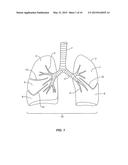 Devices, Systems, Methods and Kits for Performing Selective Dissection of     Lung Tissue diagram and image