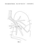 Devices, Systems, Methods and Kits for Performing Selective Dissection of     Lung Tissue diagram and image