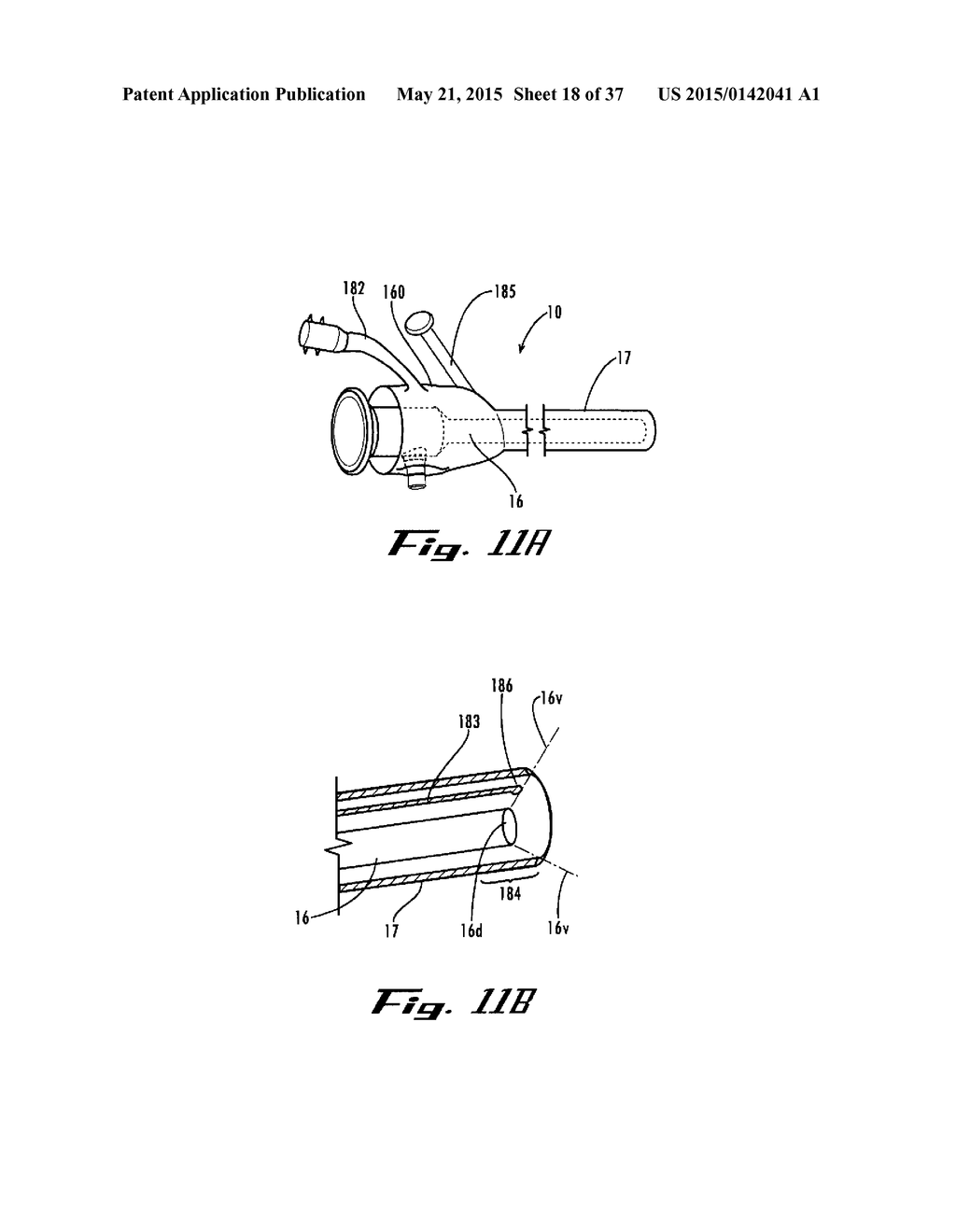 APPARATUS AND METHODS FOR PERFORMING MINIMALLY-INVASIVE SURGICAL     PROCEDURES - diagram, schematic, and image 19