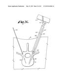 SPINAL FIXATION TOOL ATTACHMENT STRUCTURE diagram and image