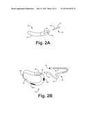 SYSTEMS AND METHODS FOR LEADLESS CARDIAC RESYNCHRINIZATION THERAPY diagram and image