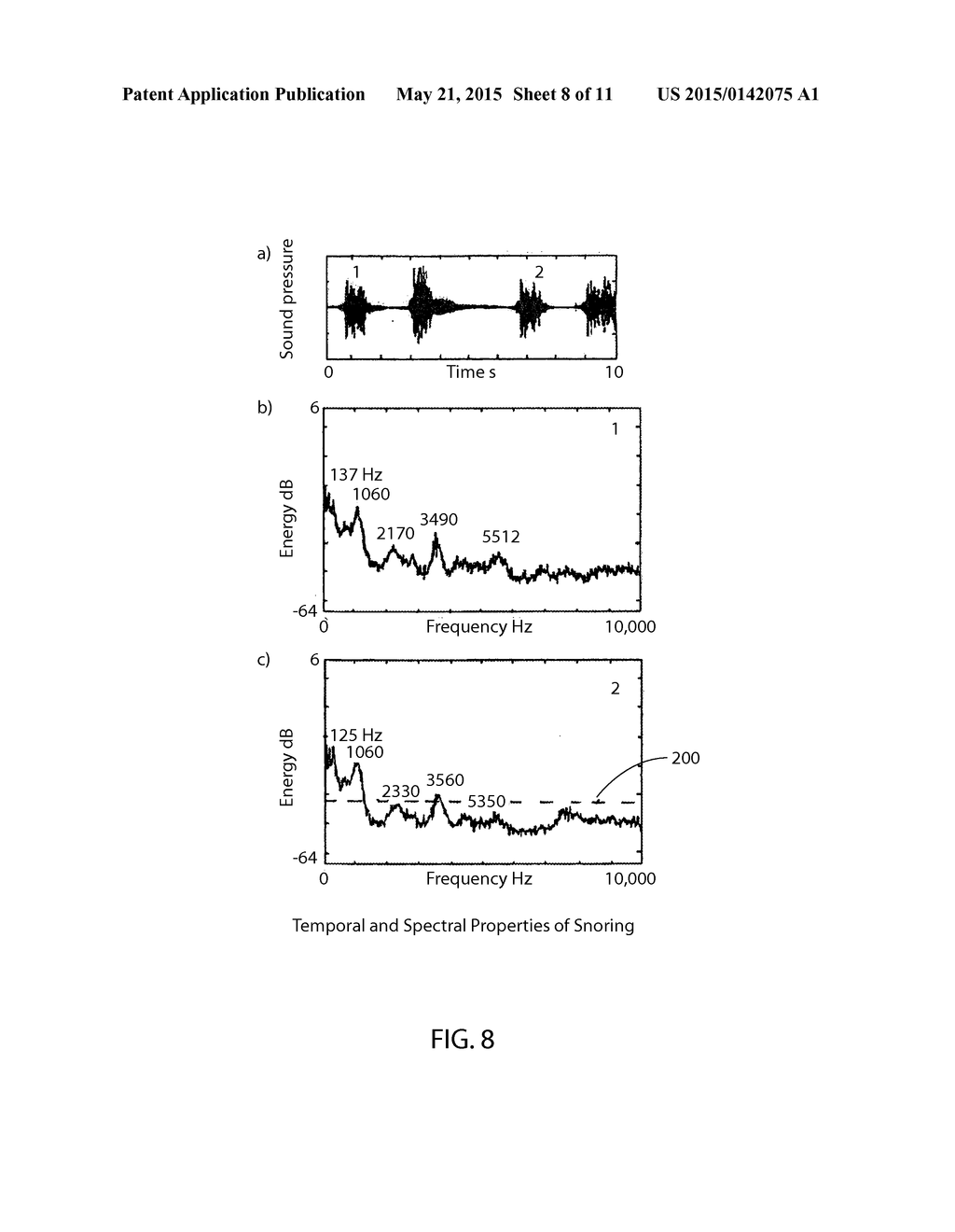 Sleep Apnea Control Device - diagram, schematic, and image 09