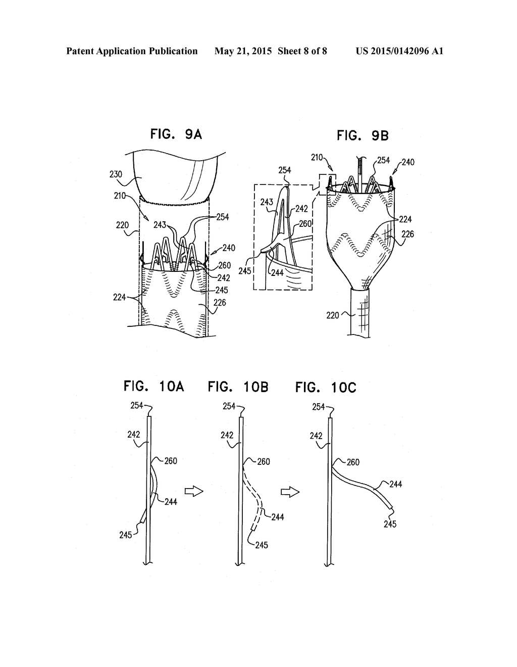 STENT-GRAFT WITH FIXATION ELEMENTS THAT ARE RADIALLY CONFINED FOR DELIVERY - diagram, schematic, and image 09