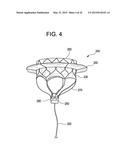 MULTI-COMPONENT DESIGNS FOR HEART VALVE RETRIEVAL DEVICE, SEALING     STRUCTURES AND STENT ASSEMBLY diagram and image