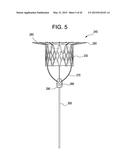 MULTI-COMPONENT DESIGNS FOR HEART VALVE RETRIEVAL DEVICE, SEALING     STRUCTURES AND STENT ASSEMBLY diagram and image