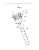 MULTI-COMPONENT DESIGNS FOR HEART VALVE RETRIEVAL DEVICE, SEALING     STRUCTURES AND STENT ASSEMBLY diagram and image