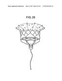 MULTI-COMPONENT DESIGNS FOR HEART VALVE RETRIEVAL DEVICE, SEALING     STRUCTURES AND STENT ASSEMBLY diagram and image