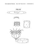 MULTI-COMPONENT DESIGNS FOR HEART VALVE RETRIEVAL DEVICE, SEALING     STRUCTURES AND STENT ASSEMBLY diagram and image