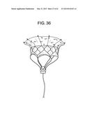 MULTI-COMPONENT DESIGNS FOR HEART VALVE RETRIEVAL DEVICE, SEALING     STRUCTURES AND STENT ASSEMBLY diagram and image