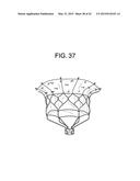 MULTI-COMPONENT DESIGNS FOR HEART VALVE RETRIEVAL DEVICE, SEALING     STRUCTURES AND STENT ASSEMBLY diagram and image