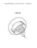 MULTI-COMPONENT DESIGNS FOR HEART VALVE RETRIEVAL DEVICE, SEALING     STRUCTURES AND STENT ASSEMBLY diagram and image