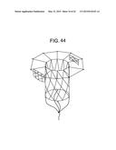 MULTI-COMPONENT DESIGNS FOR HEART VALVE RETRIEVAL DEVICE, SEALING     STRUCTURES AND STENT ASSEMBLY diagram and image