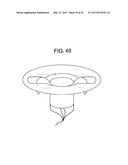 MULTI-COMPONENT DESIGNS FOR HEART VALVE RETRIEVAL DEVICE, SEALING     STRUCTURES AND STENT ASSEMBLY diagram and image