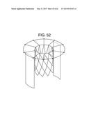 MULTI-COMPONENT DESIGNS FOR HEART VALVE RETRIEVAL DEVICE, SEALING     STRUCTURES AND STENT ASSEMBLY diagram and image