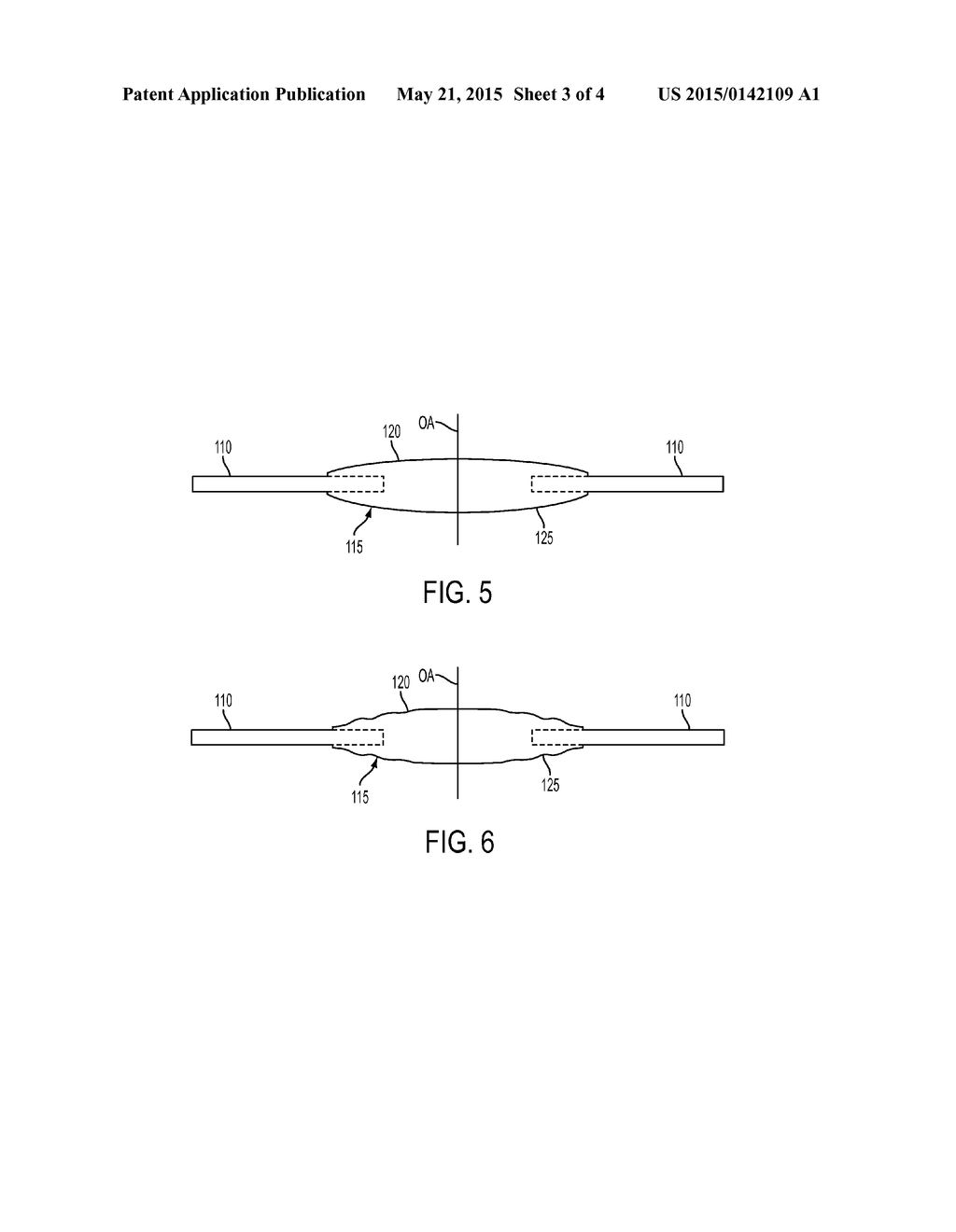 OPHTHALMIC LENSES WITH ENHANCED SURFACE AND METHODS OF FABRICATION THEREOF - diagram, schematic, and image 04