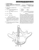 SPINAL IMPLANT APPARATUS AND METHODS diagram and image