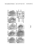 Methods And Compositions Comprising A Drosophila Model Of Amyotrophic     Lateral Sclerosis diagram and image