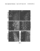 Methods And Compositions Comprising A Drosophila Model Of Amyotrophic     Lateral Sclerosis diagram and image