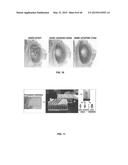 Methods And Compositions Comprising A Drosophila Model Of Amyotrophic     Lateral Sclerosis diagram and image