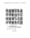 Methods And Compositions Comprising A Drosophila Model Of Amyotrophic     Lateral Sclerosis diagram and image