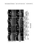 Methods And Compositions Comprising A Drosophila Model Of Amyotrophic     Lateral Sclerosis diagram and image