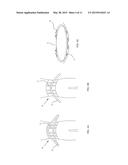 Watersport Hiking Support System diagram and image