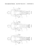 Watersport Hiking Support System diagram and image