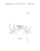 SYSTEM AND METHOD FOR CAPTURED INNER FIXED STRUCTURE diagram and image