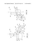 METHOD AND TOOL FOR CHECKING ALIGNMENT BETWEEN GEARS diagram and image