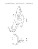 OPHTHALMIC SURGICAL SYSTEMS, METHODS, AND DEVICES diagram and image