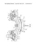 OPHTHALMIC SURGICAL SYSTEMS, METHODS, AND DEVICES diagram and image