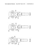 OPHTHALMIC SURGICAL SYSTEMS, METHODS, AND DEVICES diagram and image