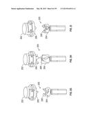 OPHTHALMIC SURGICAL SYSTEMS, METHODS, AND DEVICES diagram and image