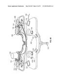 OPHTHALMIC SURGICAL SYSTEMS, METHODS, AND DEVICES diagram and image