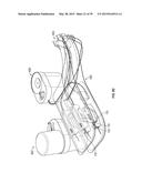 OPHTHALMIC SURGICAL SYSTEMS, METHODS, AND DEVICES diagram and image